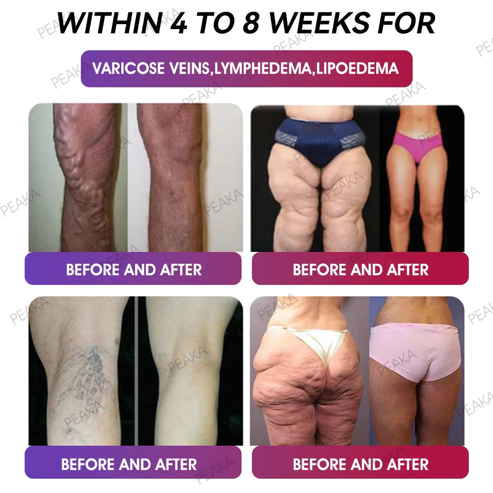 ๐๐๐๐๐๐๐๐ ๐๐ก๐๐๐ | PEAKAยฎ GLPโ1 Slimming Vitality Boost Oral Strips ๐ฉโโ๏ธ๐ฅ(Just once a week, visible changes in 7 days โ
For obesity, cardiovascular health, diabetes, sleep apnea, joint issues, and more)