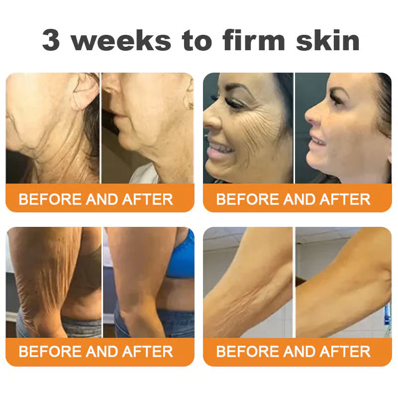 Made and Shipped from USA 🥑 LipMaps® Bee Venom Skin Restoration Cream ⏰ LAST DAY 80% OFF
